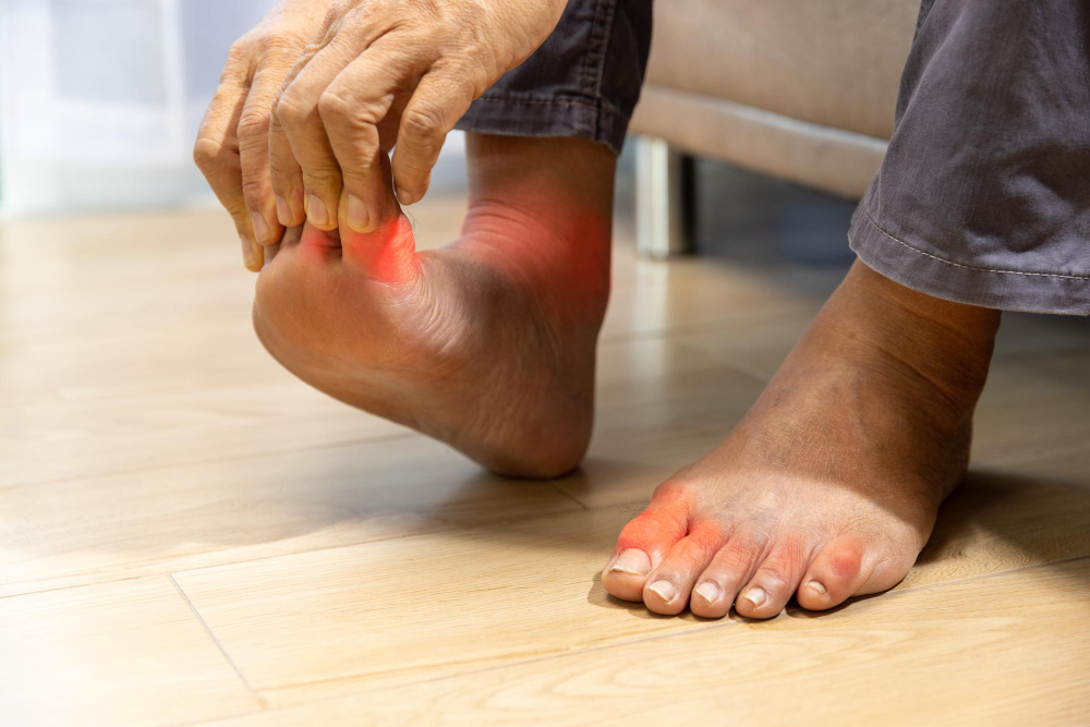 Gout